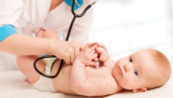 Những dấu hiệu nhận biết trẻ mắc bệnh tay chân miệng và cách phòng tránh