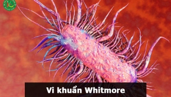 Bộ Y tế khuyến cáo 5 cách phòng tránh bệnh Whitmore