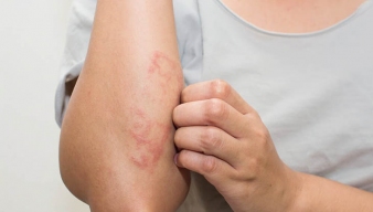 5 TRIỆU CHỨNG CẢNH BÁO GAN KHÔNG KHỎE