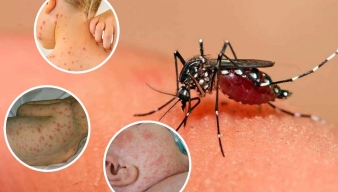 6 BIẾN CHỨNG ĐẶC BIỆT NGUY HIỂM CỦA SỐT XUẤT HUYẾT