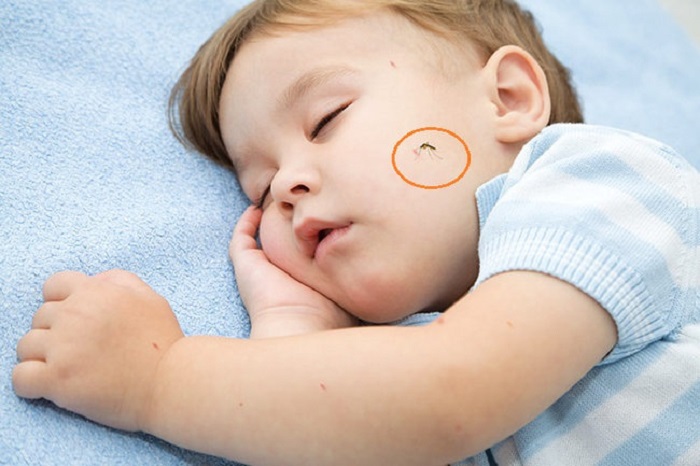 Viêm não Nhật Bản là bệnh lý có thể gặp ở trẻ vào mùa nắng nóng